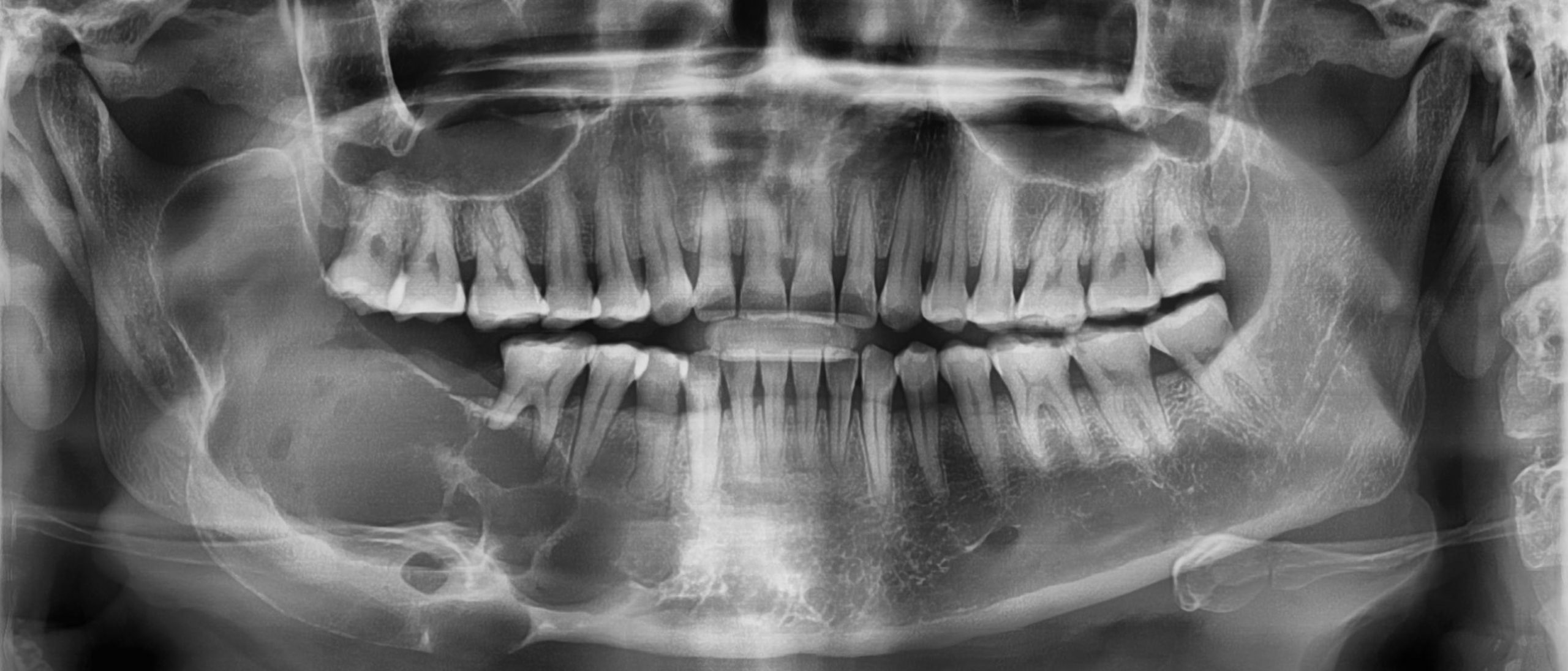 Is Maxillofacial Surgery Free On Nhs Is Maxillofacial Surgery Free On Nhs