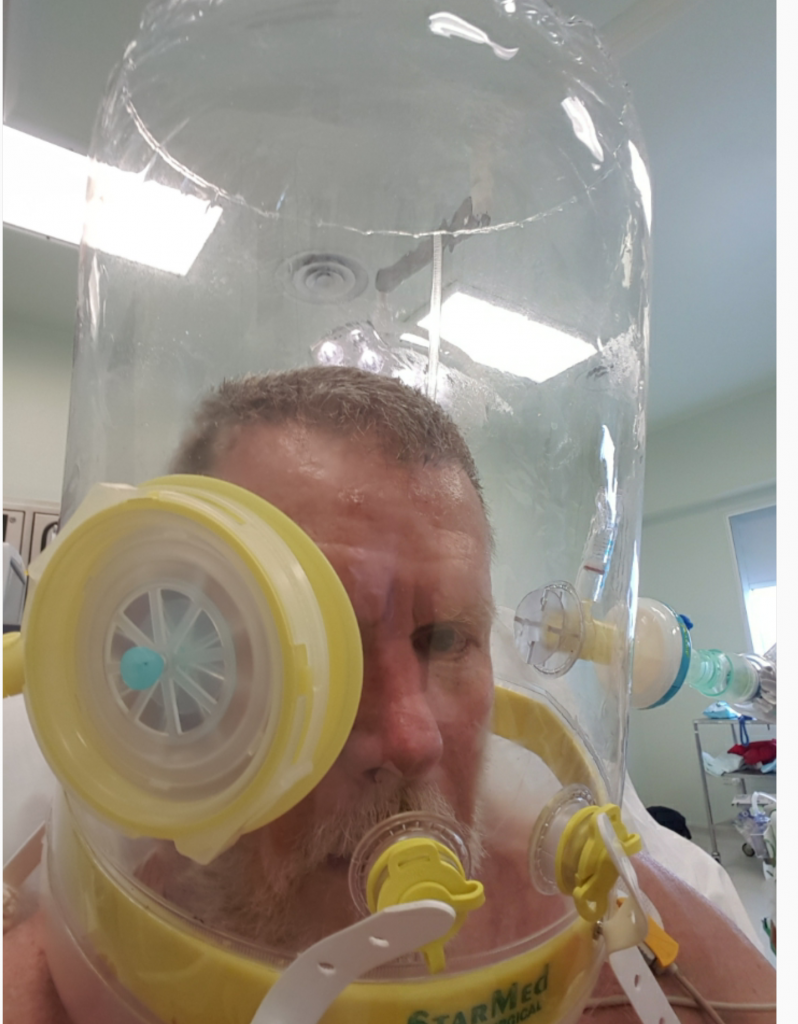 Consett Powerlifter Alan Turner in hospital wearing a CPAP hood