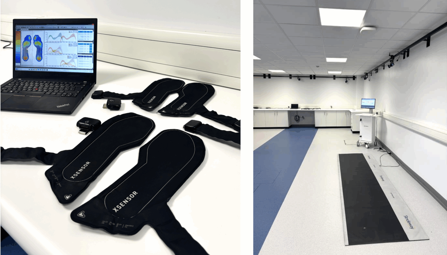 Gait analysis - Newcastle Hospitals NHS Foundation Trust