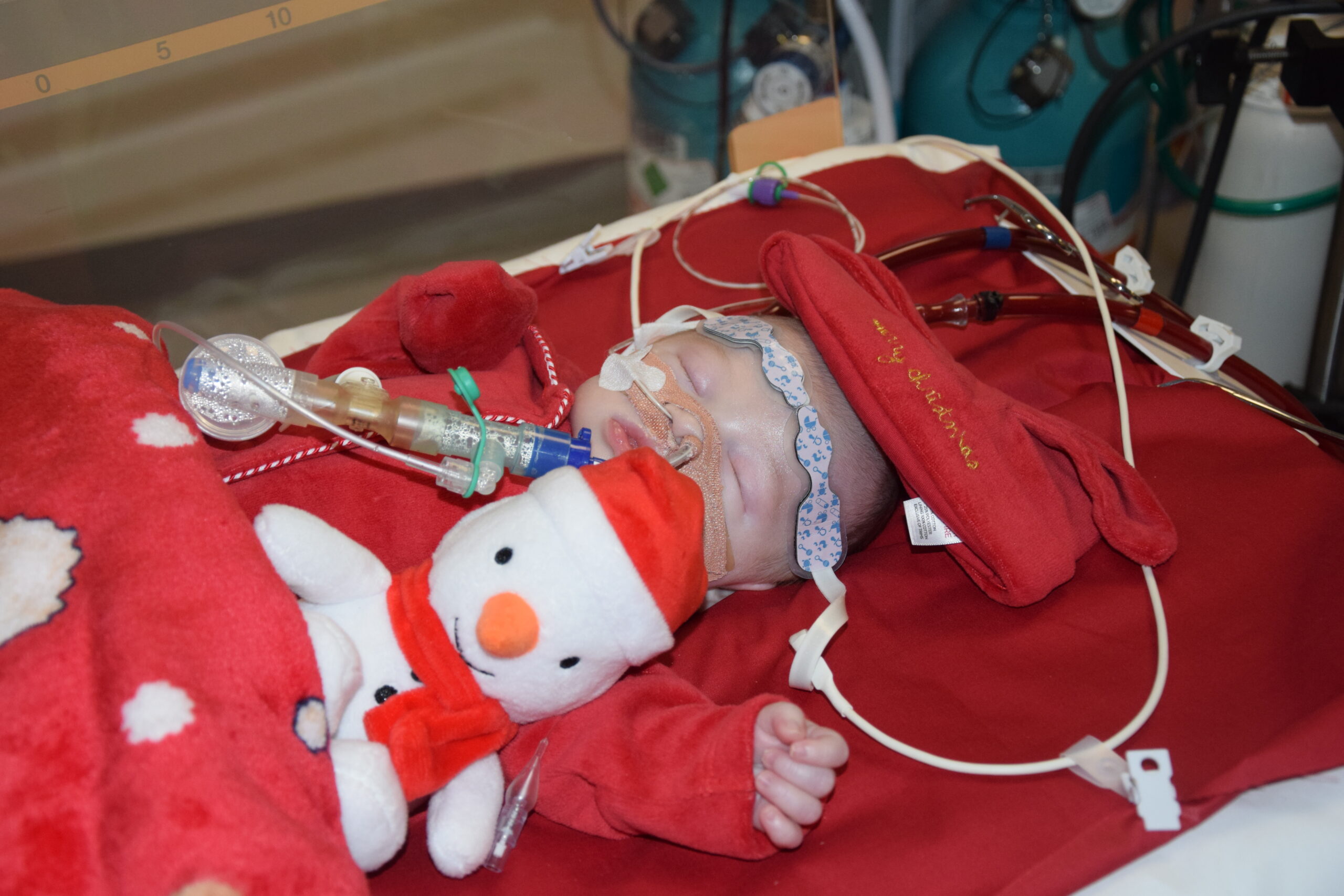 Mum's desperate wait for a donor heart for her baby son Newcastle