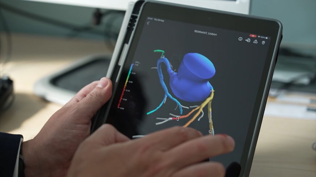 A 3D image is pictured on an electronic tablet demonstrating how the Heartflow technology works
