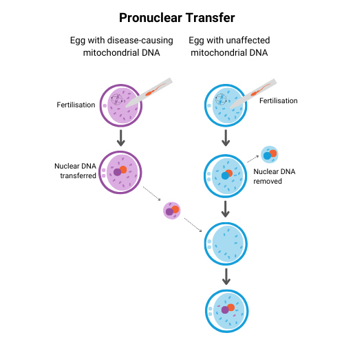 Graphic of pronuclear transfer explained. 