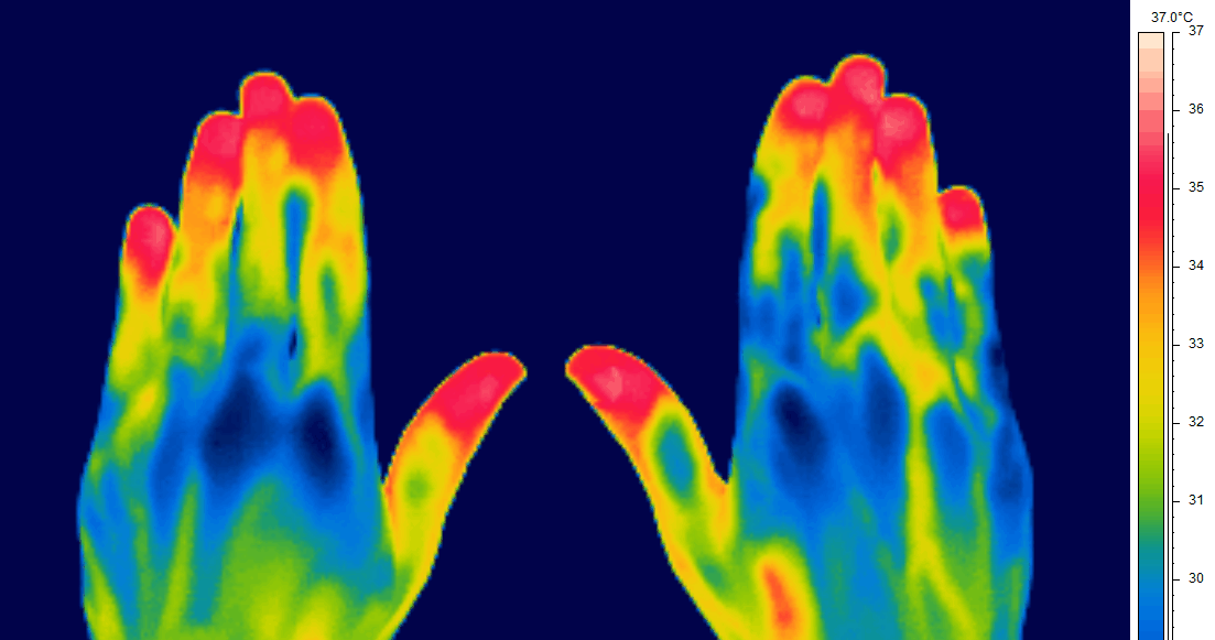 Thermal image of hands and fingers