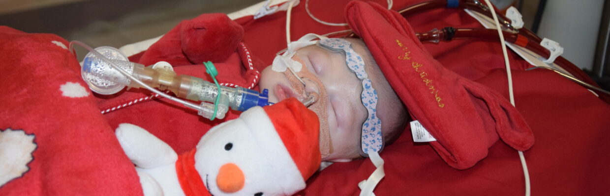 A baby with a medical device attached to its nose