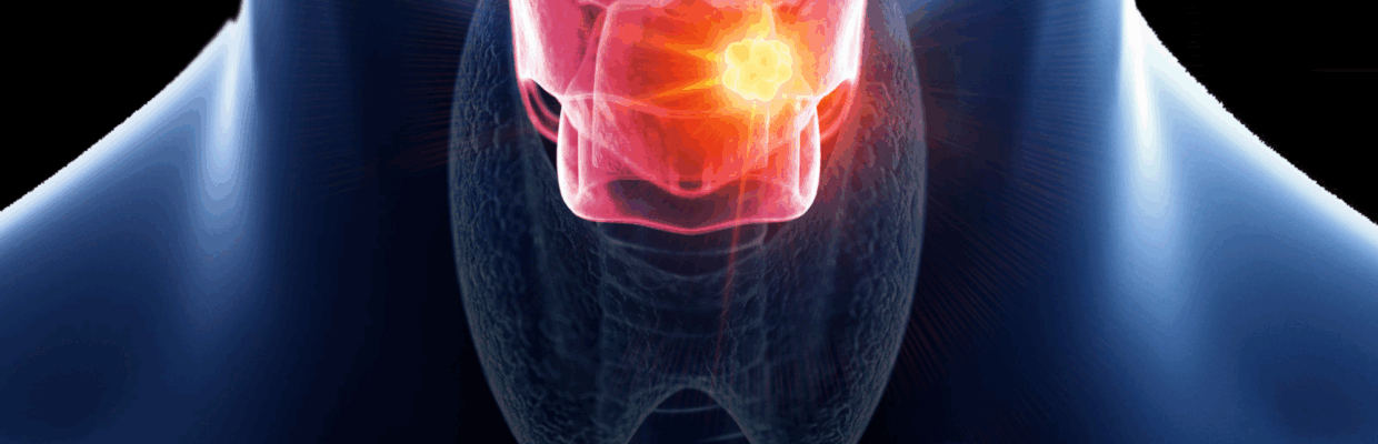 A scientific image of a persons throat highlighted red to show discomfort with a yellow mass