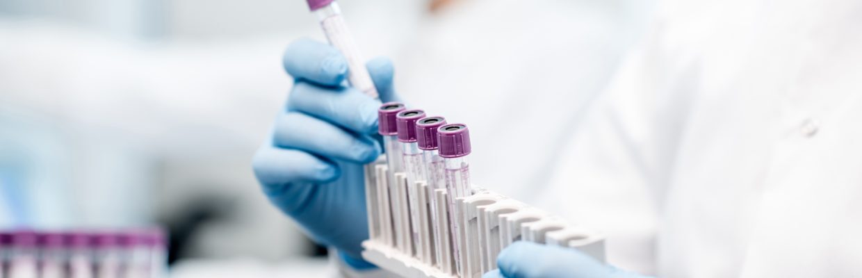 A scientist holding a rack with multiple purple - lidded tubes stored inside
