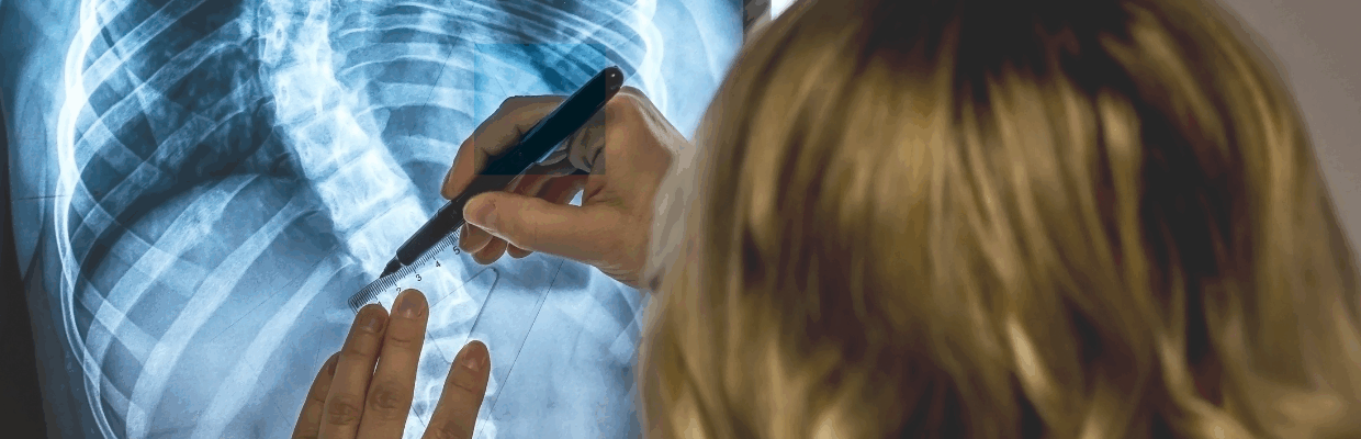 A medical professional examining an x-ray image