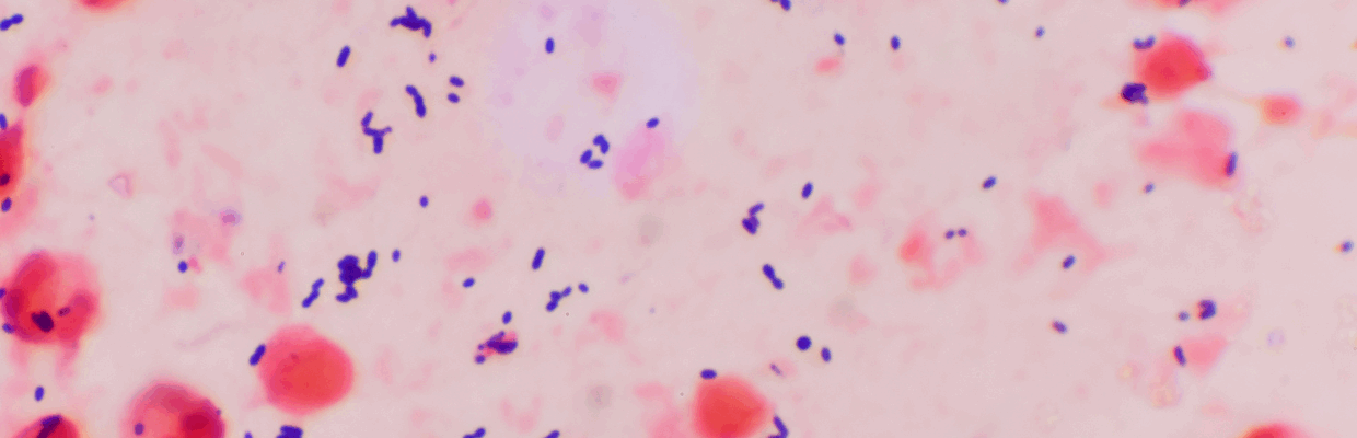 Medical image of substance under a microscope