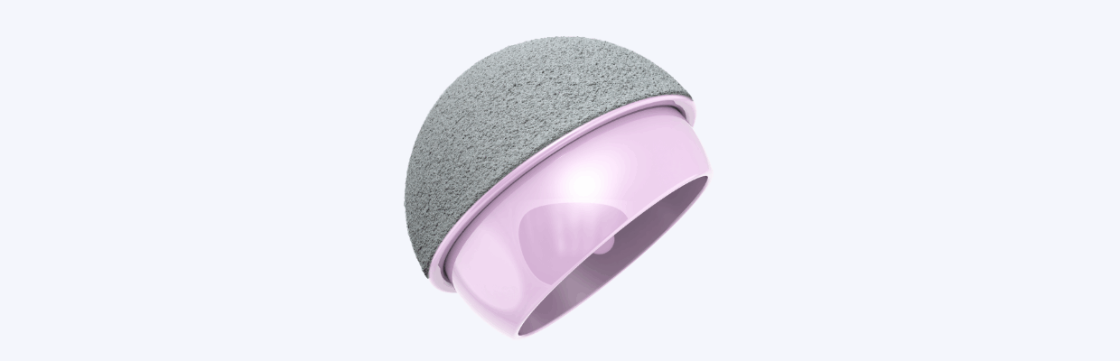 An image of a hip implant