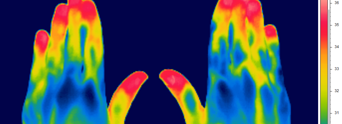 Thermal image of hands and fingers