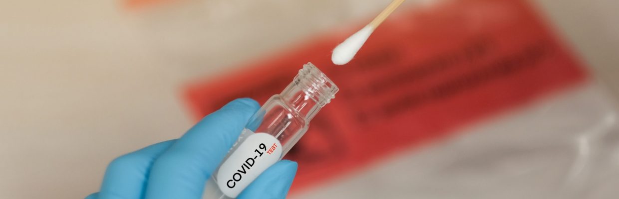 COVID-19 swabbing to test for coronavirus