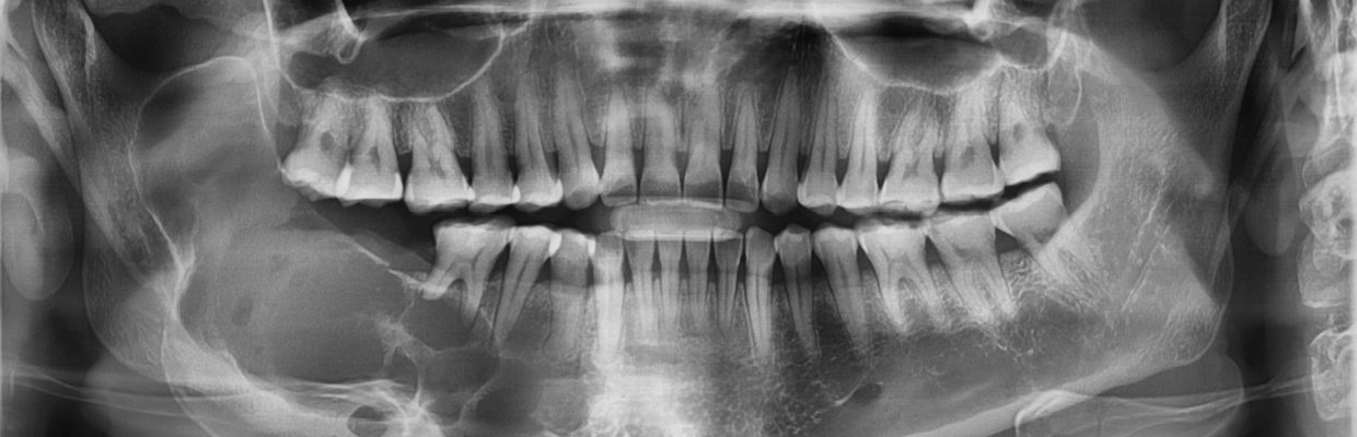 Oral and maxillofacial surgery