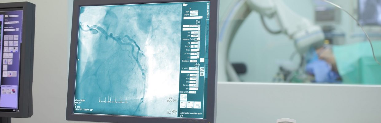 Cath labs are a cross between a theatre and a X-ray room. There is a bed and a number of monitors around the room. Sometimes there might be some equipment specific to your procedure.