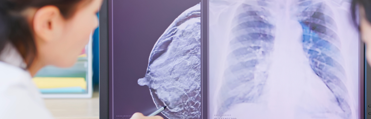 Low dose mbi new image