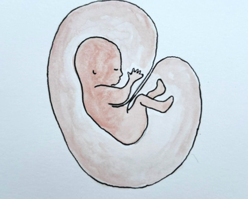 Foetal Exp Paeds2