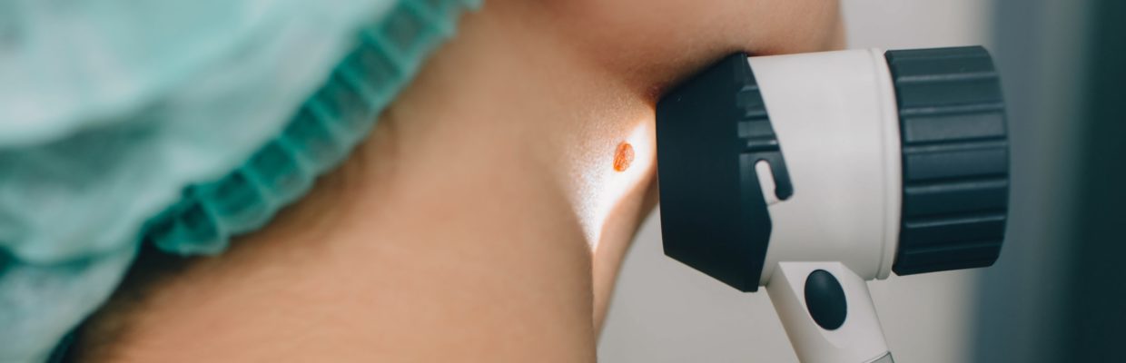 Clinician checking a mole in an armpit