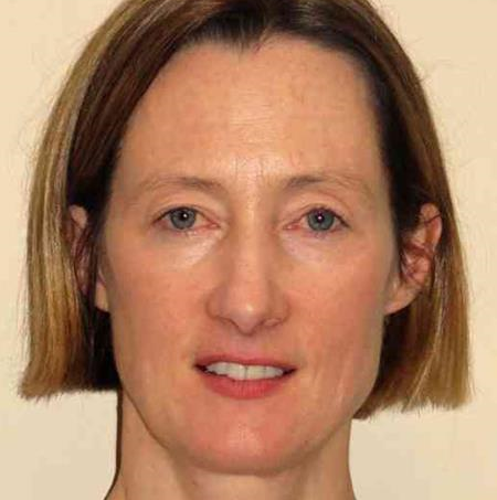Dr Sophie Weatherhead is a consultant dermatologist at Newcastle's RVI